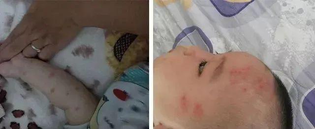 灭蚊神器怎么做_灭蚊子神器_灭蚊神器多少钱一个
