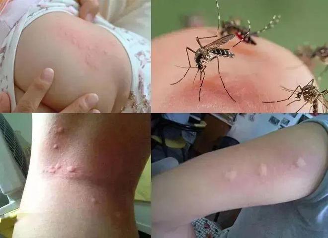 灭蚊神器多少钱一个_灭蚊神器怎么做_灭蚊子神器