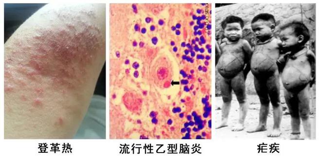 灭蚊神器怎么做_灭蚊神器多少钱一个_灭蚊子神器